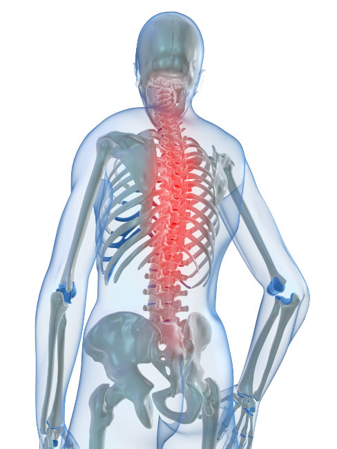 Osteopatia - dor de costas - Clínica de Osteopatia